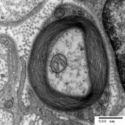 Myelinated neuron.jpg