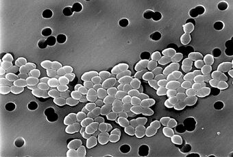 Vancomycin-Resistant Enterococcus 01.jpg