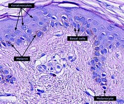 Micrograph of keratinocytes, basal cells and melanocytes in the epidermis.jpg