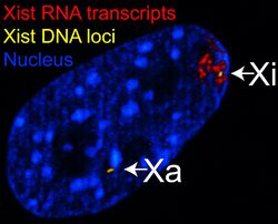 XistRNADNAFISH.jpg