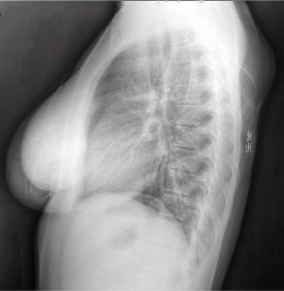 File:Medical X-Ray imaging TPH07 nevit.jpg