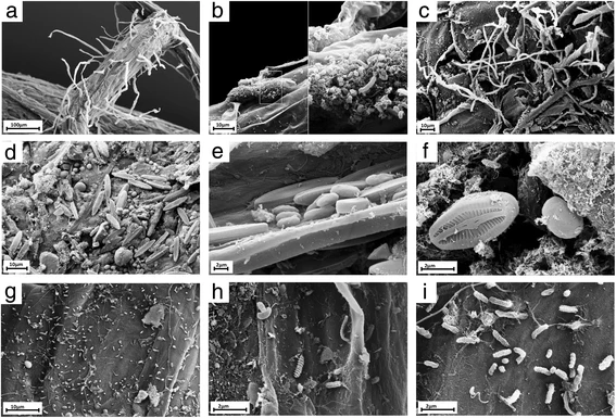 File:Microbial consortia naturally formed on the roots of Arabidopsis thaliana.webp