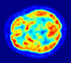 A brightly coloured blob, roughly the shape of the head sliced horizontally, on a dark blue background. Within the head is a symmetrical pattern of blobs, having the false-colours of dark blue, cyan, green, yellow and red to indicate increasing brain activity.