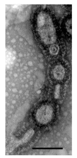 Transmission electron micrograph of Ca. A. boonei vesicles from culture (scale bar, 200nm)