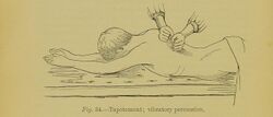 Tapotement, vibratory percussion, extracted from Lectures on massage & electricity in the treatment of disease (1891).jpg