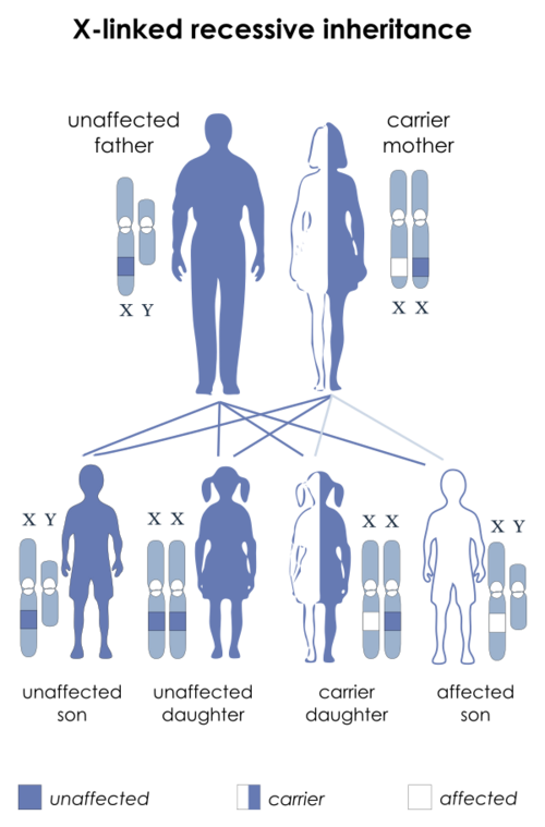 Medicine:Aarskog–Scott syndrome - HandWiki