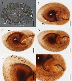 Parasite180015-fig1 Sicuophora multigranularis (Armophorea, Clevelandellida).png