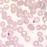 Microscope slide of small Leishmania amastigotes stained purple amongst cells