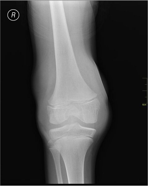 File:Medical X-Ray imaging JDH05 nevit.jpg