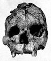 Talgai Skull