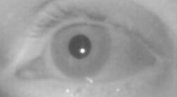 Dark pupil by infrared or near infrared illumination.jpg