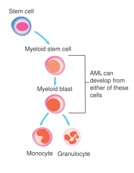 File:Diagram showing the cells in which AML starts CRUK 297.svg