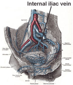 Internaliliacv.png