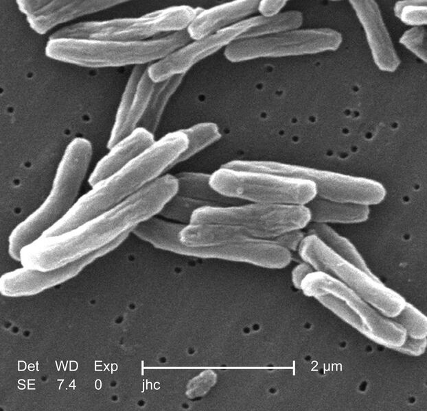 File:Mycobacterium tuberculosis.jpg