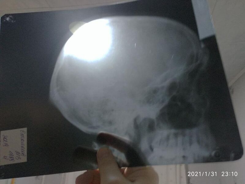 File:Рентген черепа.jpg