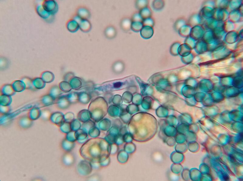 File:Unknown fruit mold with spores methylene blue x2000.jpg