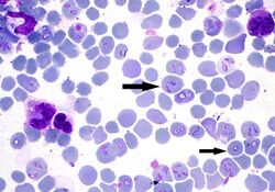 "Babesia canis" piroplasm stage infecting red blood cells of a dog. Giemsa stained.
