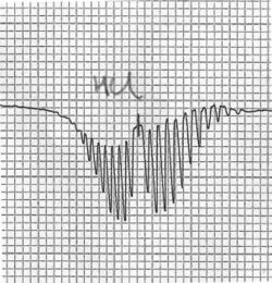 HCl rotiational spectrum.jpg