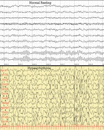 Human EEG Comparison.jpg