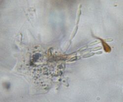 A freshwater amoeba crawling among debris on a microscope slide that is infected with a species of the fungus Amoebophilus. On the left, the amoeba has several pseudopodia extended. On the right, is a thallus of Amoebophilus that consists of four chains of spores laying in the same plane as the amoeba. The top chain points up and consists of three fully formed spores and one immature spore at the end furthest from the amoeba. The other three chains point toward the right and consist of two or three mature spores and one immature spore at the end of the chain.