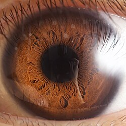 Human eye close up, anterior view.jpg