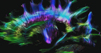 Tractography animated lateral view.gif