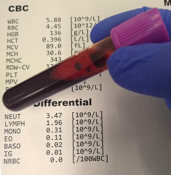 File:Complete blood count and differential.jpg