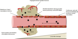 Enhanced permeability and retention (EPR) effect and passive targeting.svg
