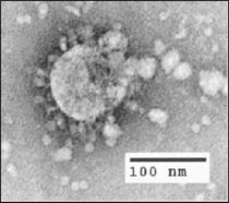 Electron micrograph of SARS-CoV.