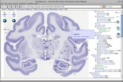 BrainMaps treewidget.jpg