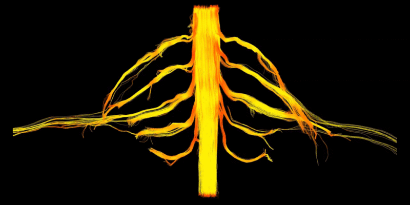 File:Deterministic Tractography of the Adult Brachial Plexus using Diffusion Tensor Imaging.gif