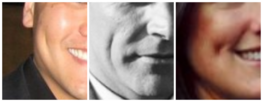 Closeups of three people's cheeks in three-quarter profile arranged in a three-panel collage: Panel one shows a diagonal, shallow-depth cheek dimple on the cheekbone in line with the earlobe; Panel 2 shows a deep, thin, curved dimple as tall as the nostril; Panel 3 shows a small, deep, round dimple under the cheekbone near the corner of the mouth.