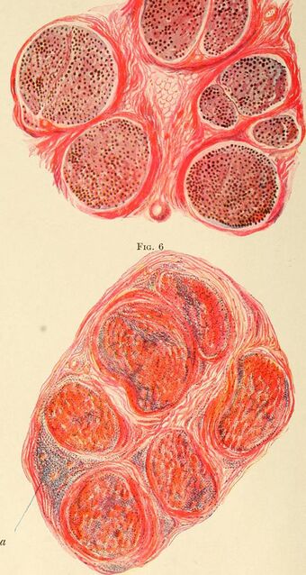 Diseases of the nervous system (1910) (14586524238).jpg