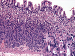 Histology of normal fundic mucosa.png