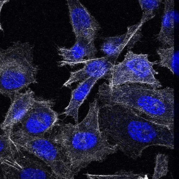 File:PC3 prostate cancer cells, confocal image, 63x.jpg