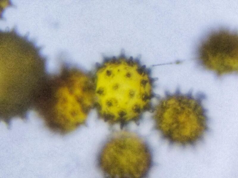 File:Pollens of Hibiscus.jpg