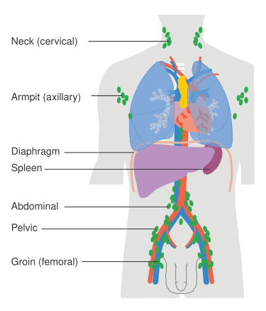 File:Diagram showing the lymph nodes lymphoma most commonly develops in CRUK 311.svg