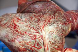 Fetal side close-up of freshly delivered placenta.jpeg