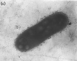 A microscope image of a massilia plicata bacterium.