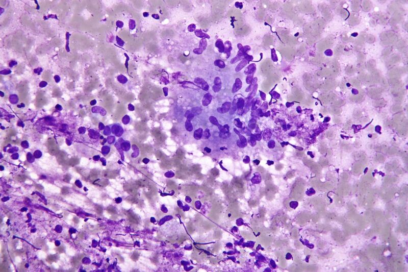 File:Granuloma cytology.jpg