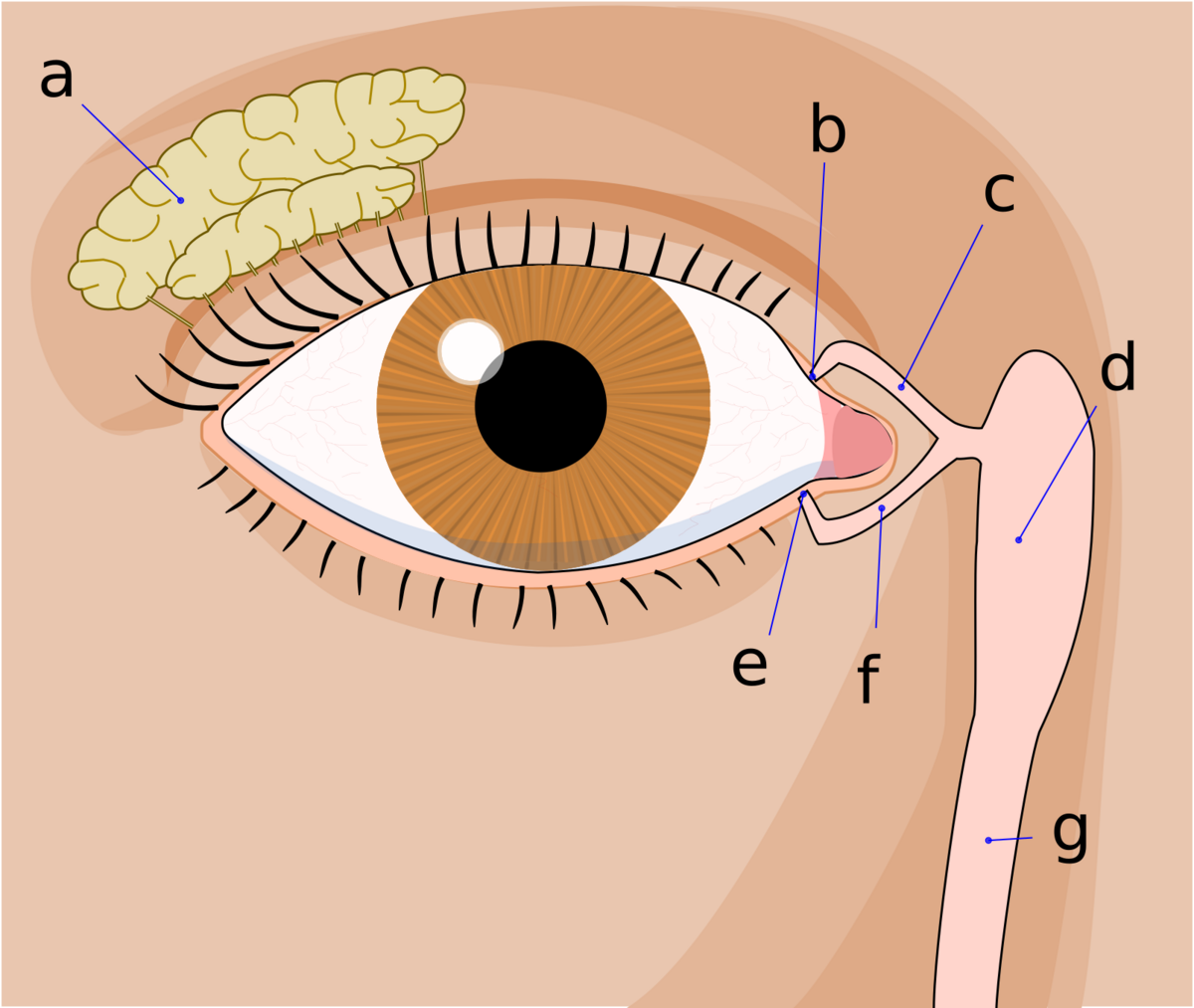 Medicinenasolacrimal Duct Obstruction Handwiki 