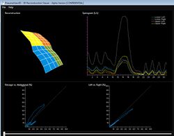 Thoracic Patient SLP Scan