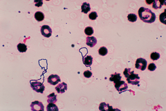 Streptococcus viridans 01.png