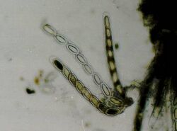 Pertusaria paratuberculifera (EU1).jpg