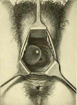 Operative gynecology - (1906) (14781201664).jpg