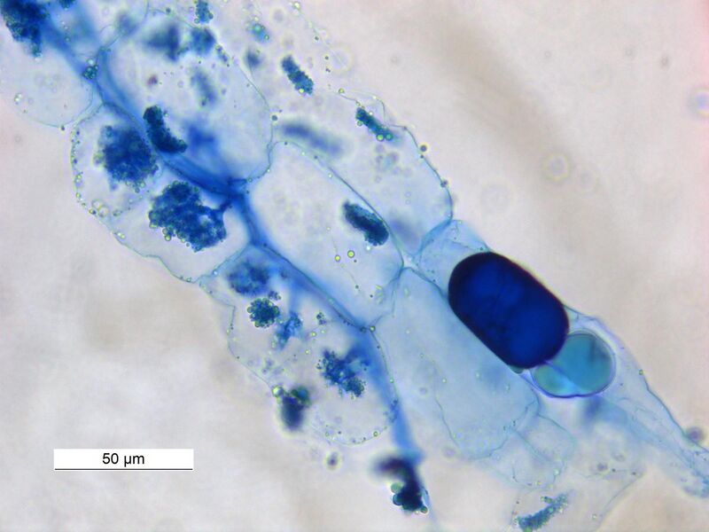 File:Vesicular Arbuscular Mycorrhizae 40X0031 03.jpg