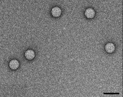 TEM micrograph of Enterovirus 71 virions. Scale bar, 50 nm.