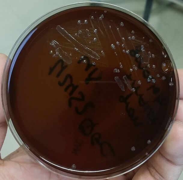 File:Neisseria gonorrhoeae Growth on New York City Agar Plate.jpg