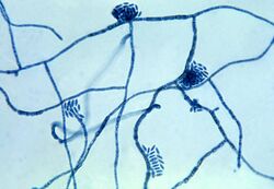 Hortaea-werneckii-fungus--causes-tinea-nigra.jpg