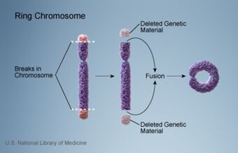 NLM ring chromosome.jpg